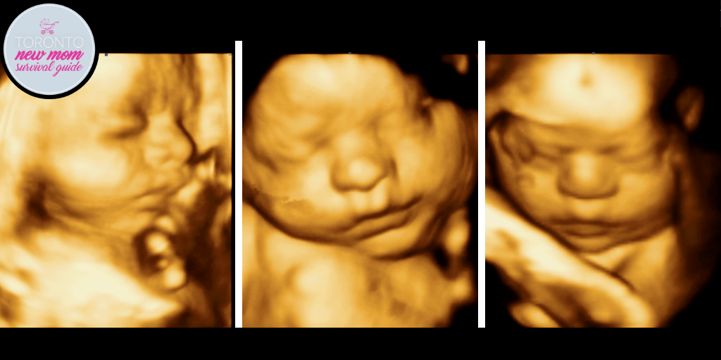 My 3D Baby Ultrasound Experience